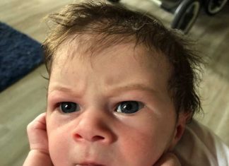 Το μωρό που γεννήθηκε «θυμωμένο»